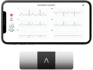 6-lead ECG device with smartphone