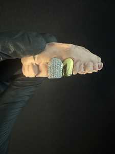 Grillz Teeth: Custom VVS Grillz 2 Caps ice/gld