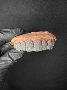 Grillz Teeth: Custom VVS Grillz 8 Top