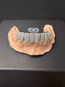 Custom VVS Grillz 8 Bottom