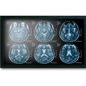 Onyx MEDDP-622HPN 21.5" Medical Touch Display