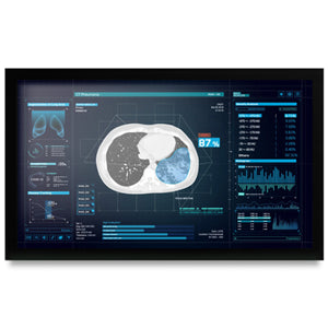 Onyx MEDDP-627HPN 27" Medical Touch Display