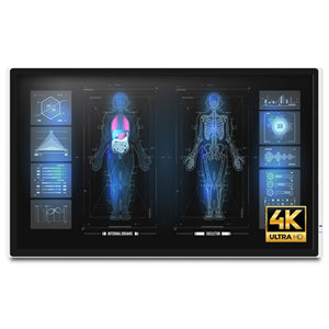 Onyx: Onyx MEDDP-632-P1 32" 4K Medical Touch Display