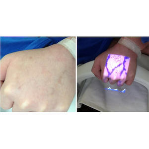 Products: Vein Finder System with stand Surgical Supplies Medical Devices NZ