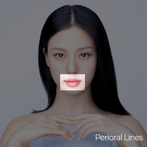 Ultraformer MPT Skin Lifting and Tightening Perioral Lines Treatment Korea Beauty Clinic