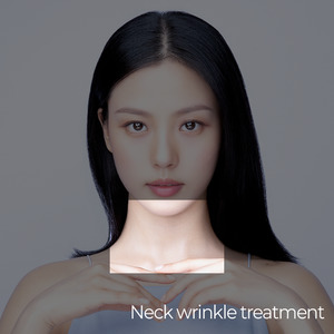 Ultraformer MPT Neck Treatment – Skin Lifting and Tightening
