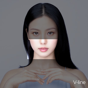 Ultraformer MPT V-Line Lifting (Jawline Lift)skin lifting and tightening