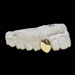 custom made grillz: One tooth in 9kt Gold