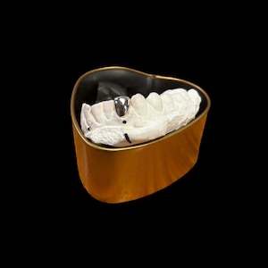 Custom Made Grillz: Four teeth in 9kt gold