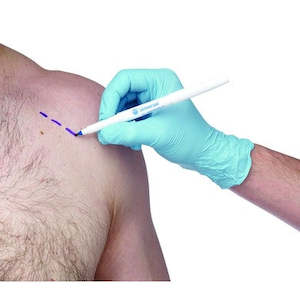 Dissection: Surgical Skin Marking Pen - Single