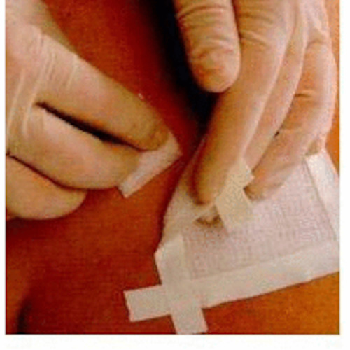 Patient Transfer: EuroSplint 110mm x 900mm