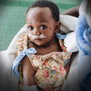 Cleft lip or palate surgery $400