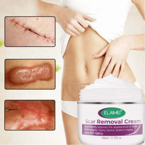 New Collection: Scar Removal Cream