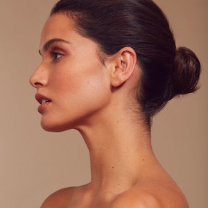 Treatments: Dermal Fillers