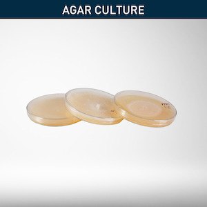 All: Mushroom Cultures | Agar