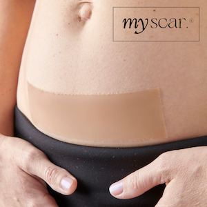 Myscar Monthly Caesarean silicone strips Myscar