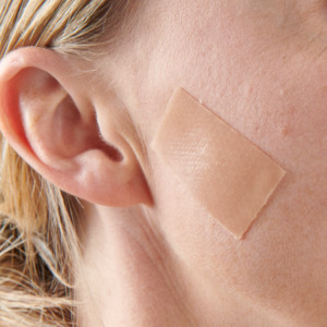 Myscar Face silicone strips - large 7.5cm - 4 month supply Myscar