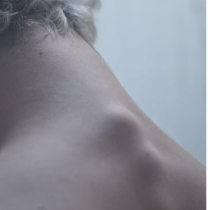 Neuro Tappies: Neck Issues Self Treatment