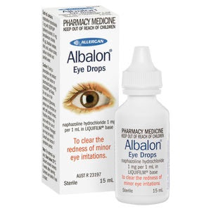 Eye Care: Albalon Eye Drops 15ml
