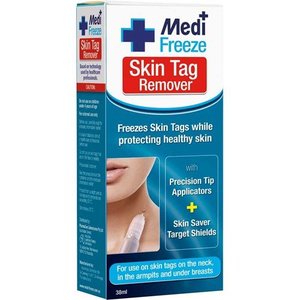 Wart Treatments: Medi Freeze Skin Tag Remover 38ml