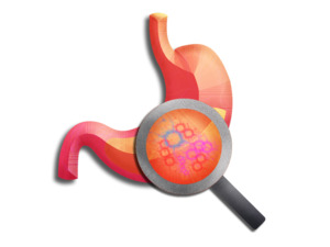 Tests 1: Vibrant Labs- Gut Zoomer (excludes Lab fee)