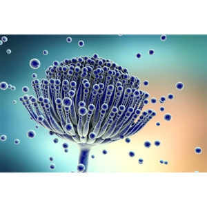 Tests 1: Mosaic Labs- MycoTOX urine test