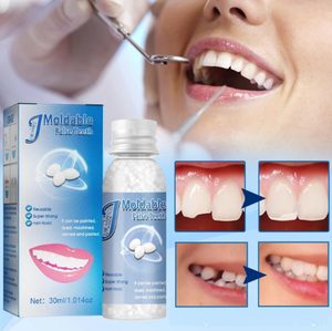 Car Parts Accessories: False Teeth Glue Temporary Tooth Gap Filling Repair Kit