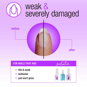 Nail Tek: Nail Tek Nail Rescue For Weak Severely Damaged Nails 3pc Kit