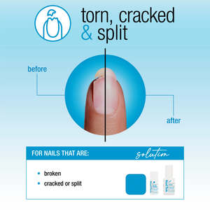 Nail Tek: Nail Tek Nail Repair For Torn, Cracked Or Split Nails 2pc Kit