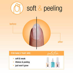Nail Tek: Nail Tek Nail Recovery For Soft Peeling Nails 3pc Kit