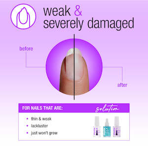 Nail Tek Nail Rescue For Weak Severely Damaged Nails 3pc Kit