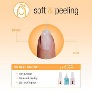 Nail Tek: Nail Tek Nail Recovery For Soft Peeling Nails 3pc Kit