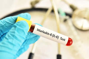 IL-6 Testing - Inflammation