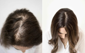 Good Hair Wigs Toppers And Toupees: Haliee 3 x 5 Hum,an Hair Topper