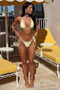 Sunkissed Bikini Bottoms - Yellow Stripe