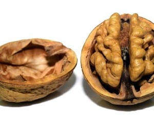 Cardiovascular Health