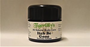 Itch Be Gone – Eczema Lotion