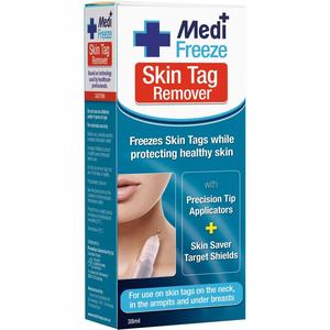 Medi Freeze Skin Tag Remover 38ml