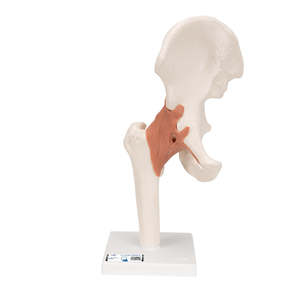 3B SCIENTIFIC FUNCTIONAL HUMAN HIP JOINT MODEL