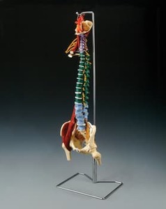 Anatomical Models: MUSCLE SPINE WITH DISORDERS