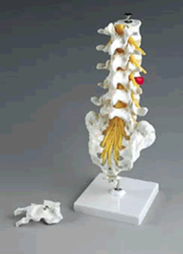 MODEL FLEXIBLE LUMBAR VERTEBRAL COLUMN WITH HERNIATED DISC