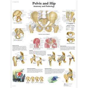 Charts: CHART PELVIS AND HIP - ANATOMY & PATHOLOGY