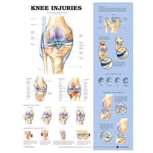 STOCK ITEM-DEFAULT-UNCLASSIFIED: CHART KNEE INJURIES